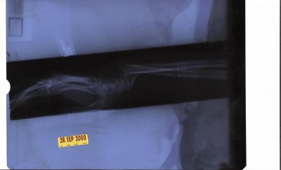 X-Ray-300.jpg