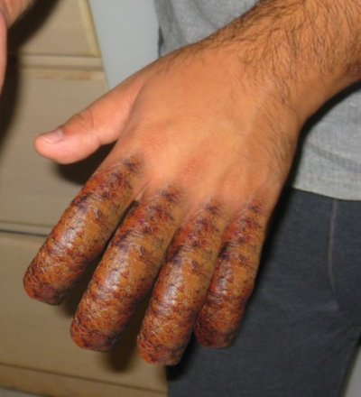 sausage_fingers.jpg